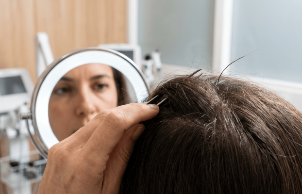 ¿Notas algo raro en tu pelo? Pistas claras de que puedes tener un problema capilar